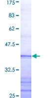 TRAF4 Protein - 12.5% SDS-PAGE Stained with Coomassie Blue.