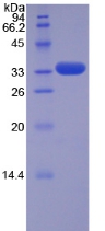 TRAF5 Protein - Recombinant TNF Receptor Associated Factor 5 By SDS-PAGE