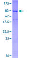 TRAF6 Protein - 12.5% SDS-PAGE of human TRAF6 stained with Coomassie Blue