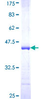 TRAF6 Protein - 12.5% SDS-PAGE Stained with Coomassie Blue.