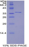 TRAF6 Protein - Recombinant TNF Receptor Associated Factor 6 By SDS-PAGE