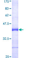 TRAF7 Protein - 12.5% SDS-PAGE Stained with Coomassie Blue.