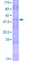 TRAIL-R3 / DCR1 Protein - 12.5% SDS-PAGE of human TNFRSF10C stained with Coomassie Blue