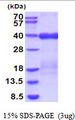 TRAIL-R3 / DCR1 Protein