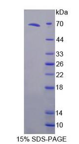 TRAIL-R3 / DCR1 Protein - Recombinant  Tumor Necrosis Factor Receptor Superfamily, Member 10C By SDS-PAGE