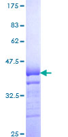 TRAIL-R4 / DCR2 Protein - 12.5% SDS-PAGE Stained with Coomassie Blue.