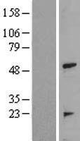 TRAIP / TRIP Protein - Western validation with an anti-DDK antibody * L: Control HEK293 lysate R: Over-expression lysate