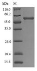 TRAIP / TRIP Protein - (Tris-Glycine gel) Discontinuous SDS-PAGE (reduced) with 5% enrichment gel and 15% separation gel.