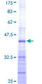 TRAIP / TRIP Protein - 12.5% SDS-PAGE Stained with Coomassie Blue.
