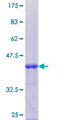 TRAK1 Protein - 12.5% SDS-PAGE Stained with Coomassie Blue.