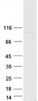 TRAK1 Protein - Purified recombinant protein TRAK1 was analyzed by SDS-PAGE gel and Coomassie Blue Staining