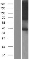 TRAM1 Protein - Western validation with an anti-DDK antibody * L: Control HEK293 lysate R: Over-expression lysate