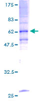 TRAM1 Protein - 12.5% SDS-PAGE of human TRAM1 stained with Coomassie Blue