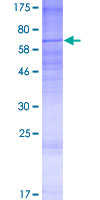 TRAM1L1 Protein - 12.5% SDS-PAGE of human TRAM1L1 stained with Coomassie Blue