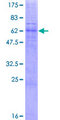 TRAM2 Protein - 12.5% SDS-PAGE of human TRAM2 stained with Coomassie Blue