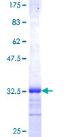 TRAM2 Protein - 12.5% SDS-PAGE Stained with Coomassie Blue.