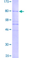 Translokin / CEP57 Protein - 12.5% SDS-PAGE of human CEP57 stained with Coomassie Blue