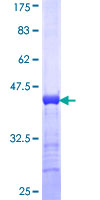 Translokin / CEP57 Protein - 12.5% SDS-PAGE Stained with Coomassie Blue.