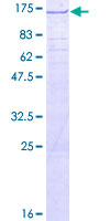 TRAPPC12 / TTC15 Protein - 12.5% SDS-PAGE of human TTC15 stained with Coomassie Blue