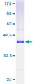 TRAPPC2 / SEDL Protein - 12.5% SDS-PAGE of human TRAPPC2 stained with Coomassie Blue