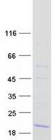 TRAPPC2 / SEDL Protein - Purified recombinant protein TRAPPC2 was analyzed by SDS-PAGE gel and Coomassie Blue Staining