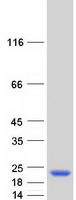 TRAPPC3 Protein - Purified recombinant protein TRAPPC3 was analyzed by SDS-PAGE gel and Coomassie Blue Staining