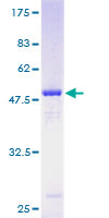 TRAPPC4 / Synbindin Protein - 12.5% SDS-PAGE of human TRAPPC4 stained with Coomassie Blue