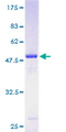 TRAPPC4 / Synbindin Protein - 12.5% SDS-PAGE of human TRAPPC4 stained with Coomassie Blue