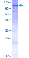 TRAPPC9 Protein - 12.5% SDS-PAGE of human NIBP stained with Coomassie Blue