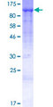 TRAPPC9 Protein - 12.5% SDS-PAGE of human NIBP stained with Coomassie Blue