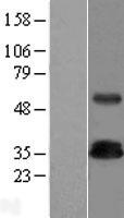 TRAT1 / TRIM Protein - Western validation with an anti-DDK antibody * L: Control HEK293 lysate R: Over-expression lysate