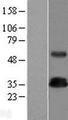 TRAT1 / TRIM Protein - Western validation with an anti-DDK antibody * L: Control HEK293 lysate R: Over-expression lysate