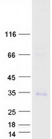 TRAT1 / TRIM Protein - Purified recombinant protein TRAT1 was analyzed by SDS-PAGE gel and Coomassie Blue Staining