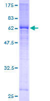 TRDMT1 / DNMT2 Protein - 12.5% SDS-PAGE of human DNMT2 stained with Coomassie Blue