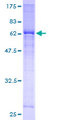 TRDMT1 / DNMT2 Protein - 12.5% SDS-PAGE of human DNMT2 stained with Coomassie Blue