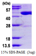 TRDMT1 / DNMT2 Protein