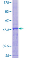TRDN / Triadin Protein - 12.5% SDS-PAGE of human TRDN stained with Coomassie Blue
