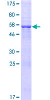 TRDV2 Protein - 12.5% SDS-PAGE of human TRDV2 stained with Coomassie Blue