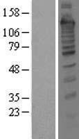 Treacle / TCOF1 Protein - Western validation with an anti-DDK antibody * L: Control HEK293 lysate R: Over-expression lysate