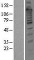 Treacle / TCOF1 Protein - Western validation with an anti-DDK antibody * L: Control HEK293 lysate R: Over-expression lysate