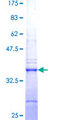 Treacle / TCOF1 Protein - 12.5% SDS-PAGE Stained with Coomassie Blue.