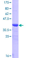 TREH Protein - 12.5% SDS-PAGE Stained with Coomassie Blue.