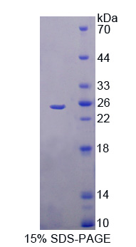 TREH Protein - Recombinant  Trehalase By SDS-PAGE