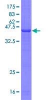 TREM1 Protein - 12.5% SDS-PAGE of human TREM1 stained with Coomassie Blue