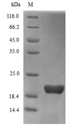 TREM2 / TREM-2 Protein - (Tris-Glycine gel) Discontinuous SDS-PAGE (reduced) with 5% enrichment gel and 15% separation gel.