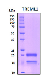 TREML1 / TLT1 Protein - SDS-PAGE under reducing conditions and visualized by Coomassie blue staining
