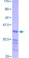 TRERF1 Protein - 12.5% SDS-PAGE Stained with Coomassie Blue.