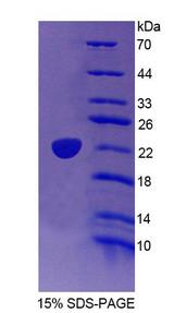 TRERF1 Protein - Recombinant Transcriptional Regulating Factor 1 By SDS-PAGE
