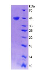 TREX1 Protein - Recombinant Three Prime Repair Exonuclease 1 By SDS-PAGE