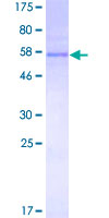 TREX1 Protein - 12.5% SDS-PAGE of human TREX1 stained with Coomassie Blue